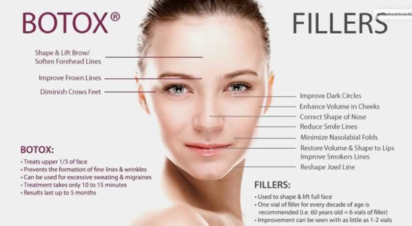 A-combination-of-facial-fillers-and-Botox